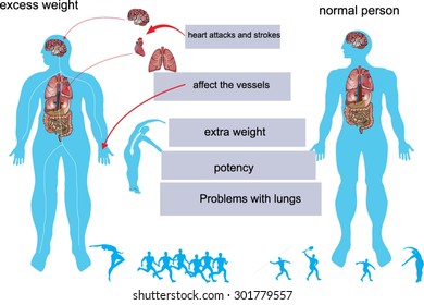 Obesity problems infographichow fatal could be a oberweight