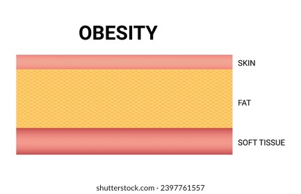 Vektorgrafik von Obesity Science Design