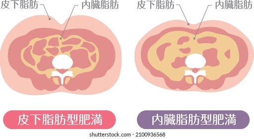 Obesity type

Described in Japanese as "subcutaneous fat", "visceral fat", "subcutaneous fat obesity", and "visceral fat obesity"