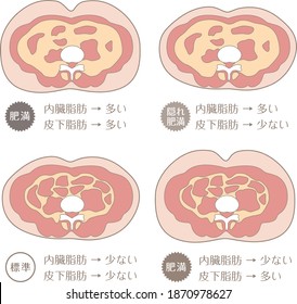 Obesity type

Described as "subcutaneous fat", "visceral fat", "obesity", "hidden obesity", "more", "less", and "standard" in Japanese