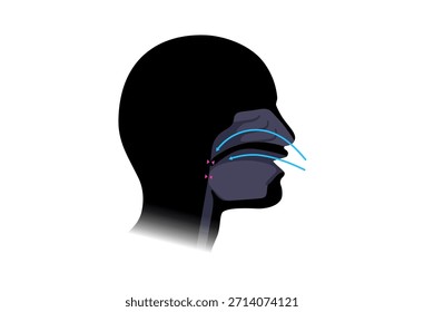 Apnea obstructiva del sueño. Las vías respiratorias colapsan durante el sueño. Pausas en la respiración, ronquidos y caídas de oxígeno. Fatiga y riesgos para la salud. Obstrucción de las vías respiratorias, posición de la lengua y Vector de tratamiento con CPAP