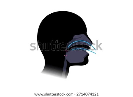 Obstructive sleep apnea. The airway collapses during sleep. Pauses in breathing, snoring, and oxygen drops. Fatigue and health risks. Airway obstruction, tongue position, and CPAP treatment vector
