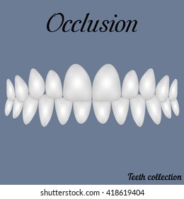 Occlusion Clenched Teeth 3d - Bite, Closure Of Teeth - Incisor, Canine, Premolar, Molar Upper And Lower Jaw. Vector Illustration For Print Or Design Of The Dental Clinic