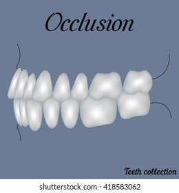 occlusion side view - bite, closure of teeth - incisor, canine, premolar, molar upper and lower jaw. Vector illustration for print or design of the dental clinic