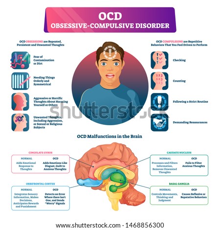 OCD obsessive compulsive disorder labeled explanation vector illustration. Medical disorder and mental illness infographic with symptoms, medical brain changes scheme and disease behavior indication.