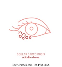 Ícone de sarcoidose ocular. Ilustração vetorial editável da inflamação granulomatosa no olho. Usado em oftalmologia, imunologia, diagnóstico, educação médica e consciência de doenças autoimunes raras