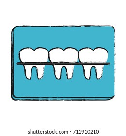 Odontology dental braces