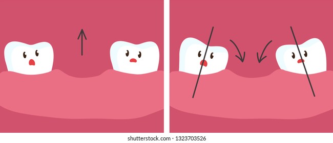 Offset teeth due to loss of teeth. Vector illustration