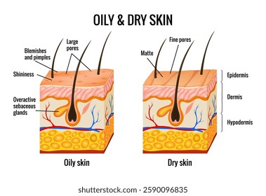 Oily and dry skin anatomy. Human body skin vector illustration with parts vein artery hair sweat gland epidermis dermis and hypodermis. Human Cross-section of the skin layers structure