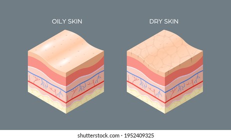 1,382 Dry skin anatomy Images, Stock Photos & Vectors | Shutterstock