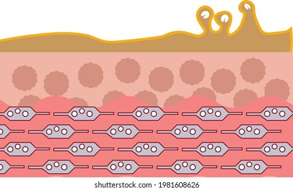 OILY SKIN ILLUSTRATION FOR PIMPLE PRONE SKIN, VS NORMAL SKIN