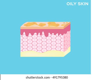 oily skin texture , vector  icon