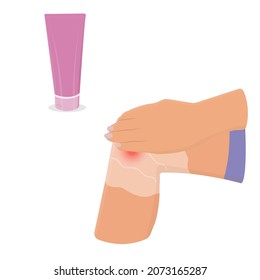 Ointment for knee pain. Vector flat illustration