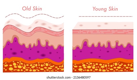 Old skin young skin, differences between. Elastic aging wrinkled, stretched anatomical structure. Skin parts,  dermis wrinkles, epidermis, collagen, elastin section. Grandmother, daughter. Draw vector