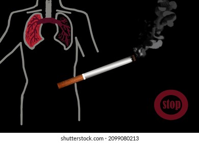 On a black background, a silhouette of a man with outlined lungs. One part of the lung is red, the other is black. Ahead is a smoking cigarette, below is the word "Stop". 