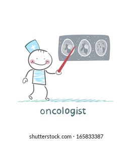oncologist shows the X-ray image