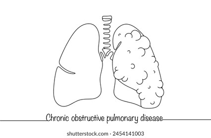 One healthy lung and the second with signs of disease. Chronic obstructive pulmonary disease. Simple line illustration for different uses.