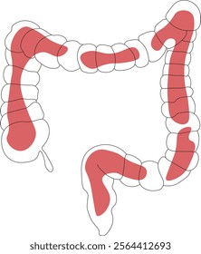 One line healthcare concept with bright spot. Healthcare vector illustration linear. Silhouette of intestine anatomy symbol. Isolated on white background. gastroenterology