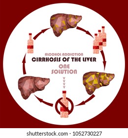 One solution against liver disease concept. Stop drinking alcohol sign. No alcohol. Low poly liver diagram banner. Vector.