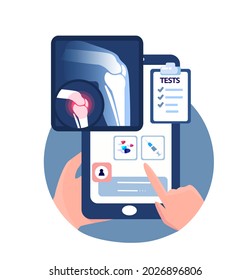 Online Touchscreen Rheumatology Orthopedics traumatology Surgery Mobile Application.Smartphone X Ray Radiography,Pain in Knee Joint. Inflammation Rontgen Tests.Internet Diagnostics.Vector Illustration