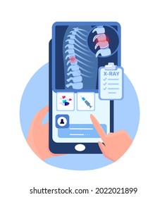 Online Touchscreen Vertebrology Orthopedics Mobile Application.Smartphone X Ray Radiography,Pain in Back Spine and Slipped Disk,Osteochondrosis,Rontgen Tests.Internet Diagnostics.Vector Illustration