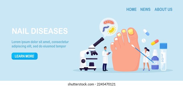 Onychomycosis. Feet with nail disease. Fungal nails infection. Doctors exam, treat nails psoriasis. Doctor dermatologist analyzes psoriatic toenails. Inflammation of toenail skin. Medical treatment