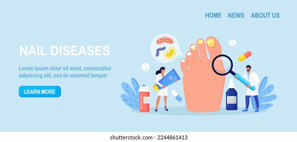 Onychomycosis. Nail disease, fungal nails infection. Doctors exam and treat nails psoriasis. Doctor dermatologist analyzes psoriatic toenails. Paronychia. Inflammation of the skin around toenail