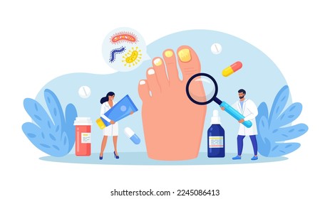 Onychomycosis. Nail disease, fungal nails infection. Doctors exam and treat nails psoriasis. Doctor dermatologist analyzes psoriatic toenails. Paronychia. Inflammation of the skin around toenail