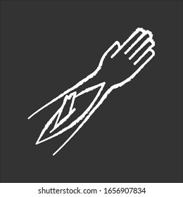 Open bone fracture chalk white icon on black background. Bone sticking out of human arm. Badly injured hand. Wounded limb. Accident. Emergency. Healthcare. Isolated vector chalkboard illustration