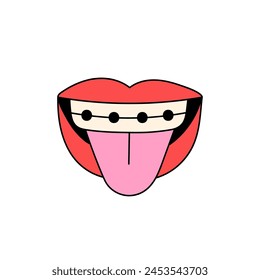 Open female mouth in retro style. Colorful groovy design element with red lips, braces on teeth. Woman shows tongue on funny symbol. Flat isolated vector illustration on white background