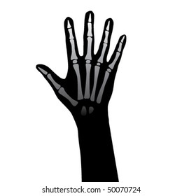 Open hand anatomy illustration.