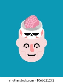 Open head and Brain.Trepanation of skull. 
