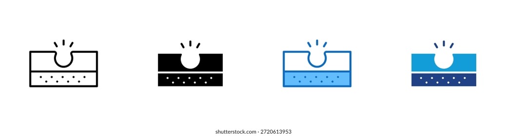 Vector de diseño de íconos de estilo múltiple de poros abiertos - Ilustración de poro de piel agrandado que muestra textura visible en la superficie