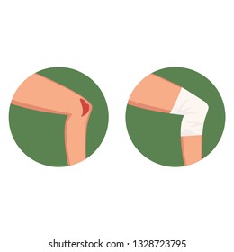 Open torn wound on the knee and medical dressing vector