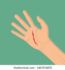 Palm with Wound Images, Stock Photos & Vectors | Shutterstock