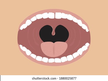 Opened Mouth concept with tonsils shown. Editable Clip art.