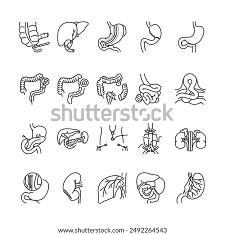 Operations on the abdominal cavity line black icons set. Signs for web page, mobile app, button, logo. Vector isolated button. Editable stroke.