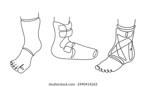 Options for fixing the foot for calcaneal fractures. Plasters, fixators and splints for legs. Isolated vector illustration with continuing line.