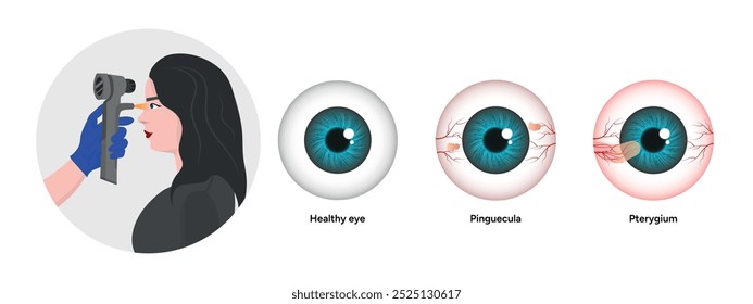 Optometrische Verabredung gesunde Augen Pinguecula und Pterygium