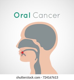 Oral Cancer vector icon design illustration