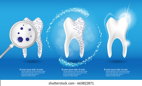 Oral Care and Dental health Concept. Shiny clean and dirty tooth on blue background, clearing tooth process. Teeth Whitening and restoration. Vector illustration