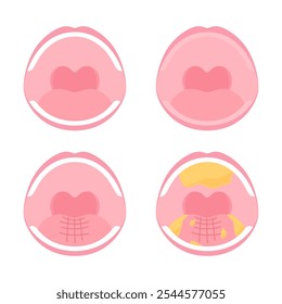 Oral cavity condition set illustration