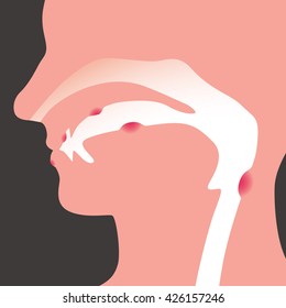 oral disease, image illustration