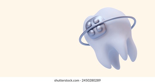 Oral health care concept with 3d realistic tooth braces isolated on light background. Vector illustration