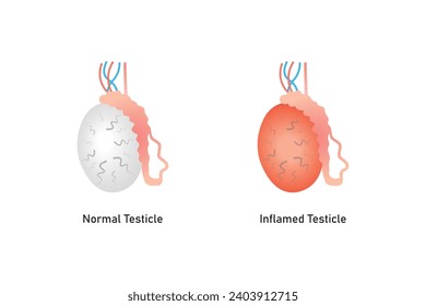 Diseño Científico de la Enfermedad de Orquitis. Ilustración vectorial.	