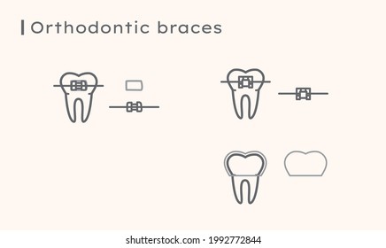 Orthodontic braces, dental equipment, tooth