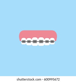 Orthodontic braces flat icon, Dental and medicine, tooth braces vector graphics, a colorful solid pattern on a blue background, eps 10.