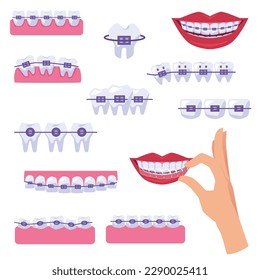 Orthodontic braces icons or symbols bundle with smiling female lips and healthy teeth with braces, flat vector illustration isolated on white background.