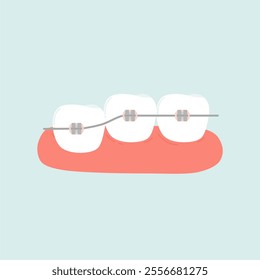 Orthodontic Braces Metal Conventional Illustration