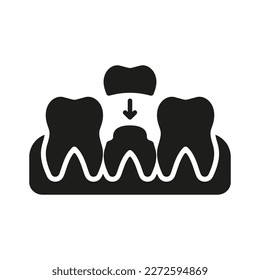 Orthodontic Denture, Dental Crown Silhouette Icon. Tooth Medical Crown. Teeth Protection Implant. Dental Treatment Sign. Oral Care Glyph Pictogram. Dentistry Symbol. Isolated Vector Illustration.